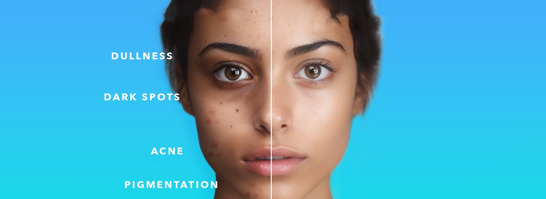 Skin’s Acting Up? Your Inner Ecosystem Might Be the Culprit