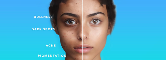 Skin’s Acting Up? Your Inner Ecosystem Might Be the Culprit